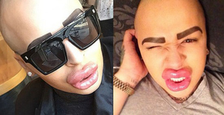 Illustration for article titled Guy spends $150,000 in plastic surgery to look like Kim Kardashian